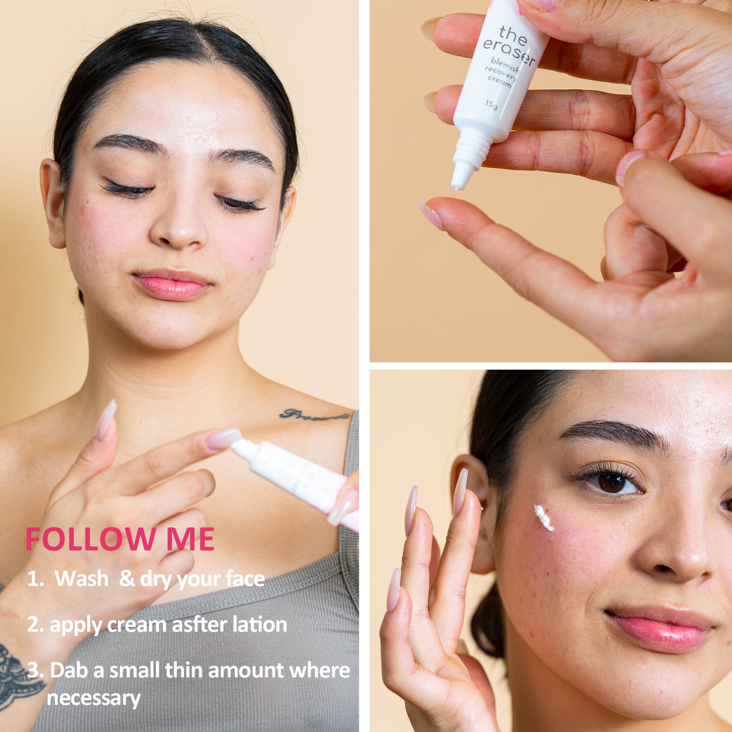 The Eraser Blemish Recovery Cream